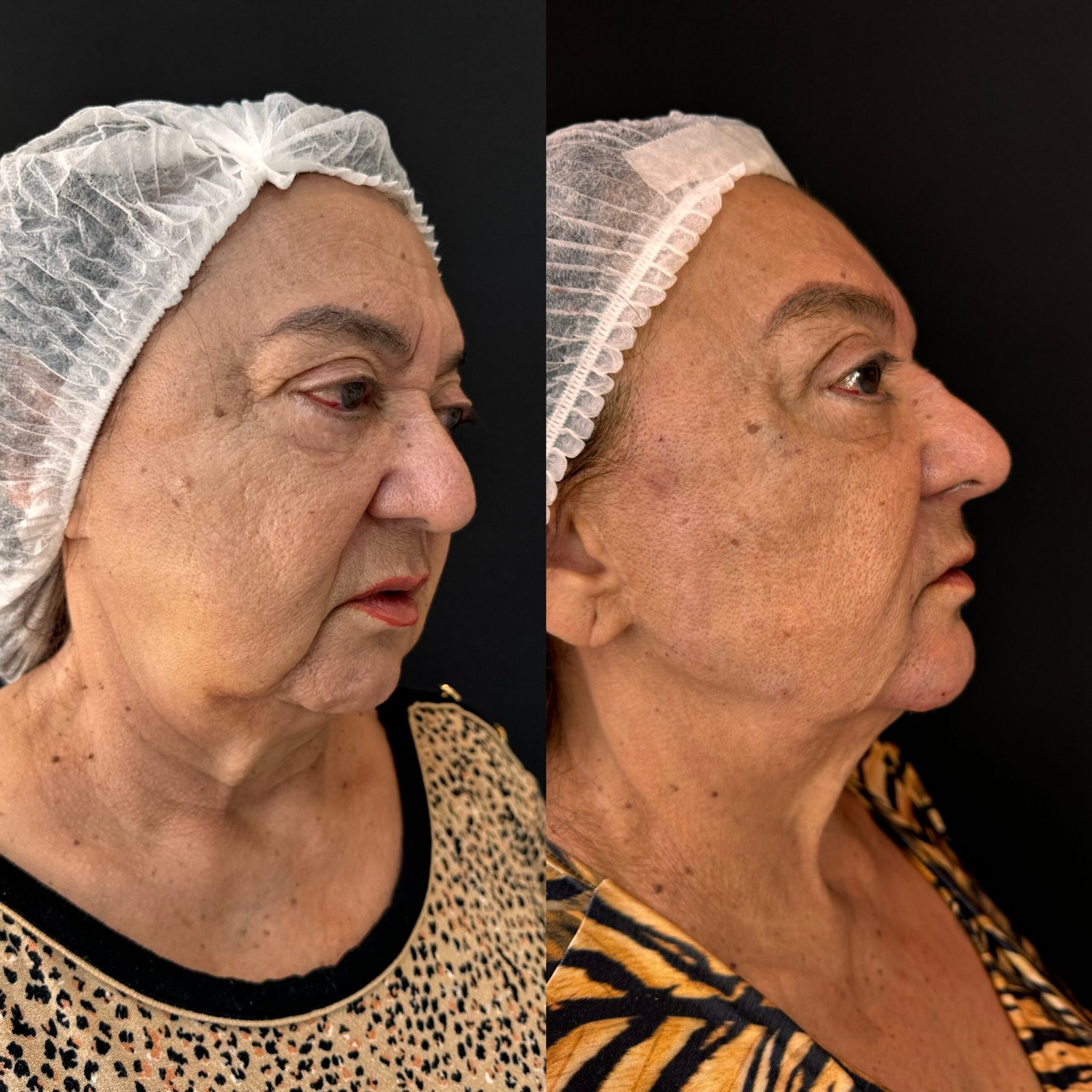 Processed with MOLDIV