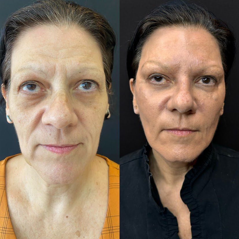 Processed with MOLDIV