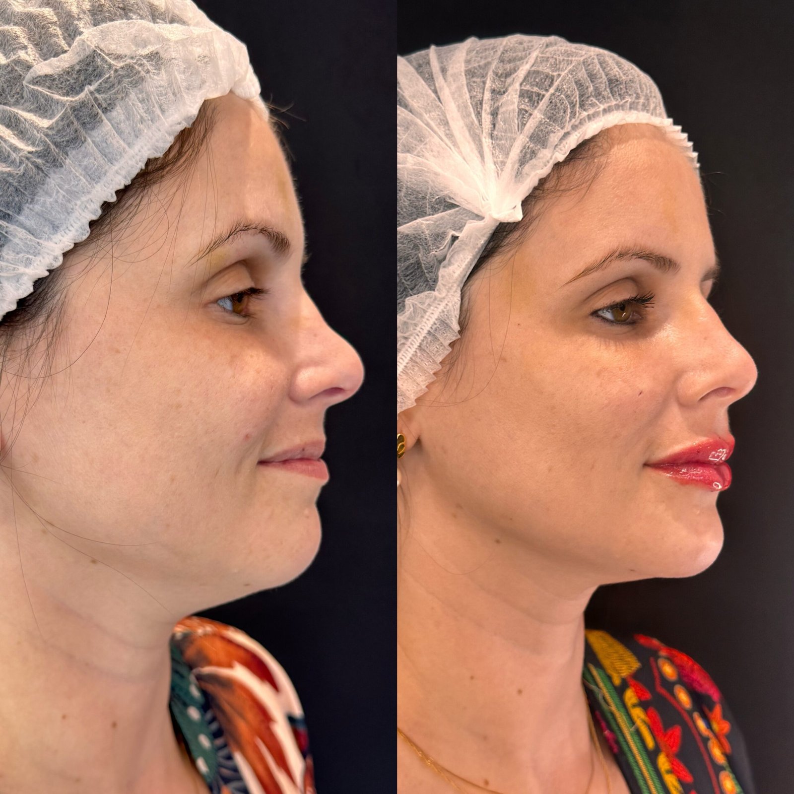 Processed with MOLDIV